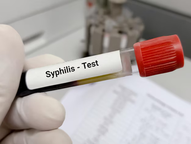 Why Early Syphilis Testing in NYC Is Crucial for Your Health