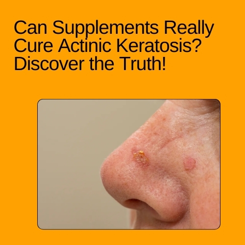 Can Supplements Really Cure Actinic Keratosis
